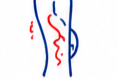 زخم عروقی